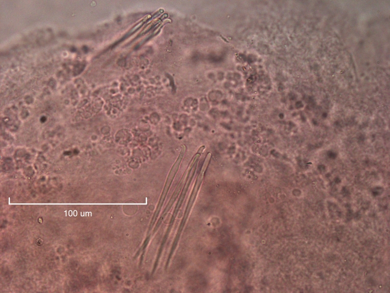 photomicrograph of part of a freshwater oligochaete worm showing two bundles of reproductive chaetae that are blunt with slightly hooked tips.