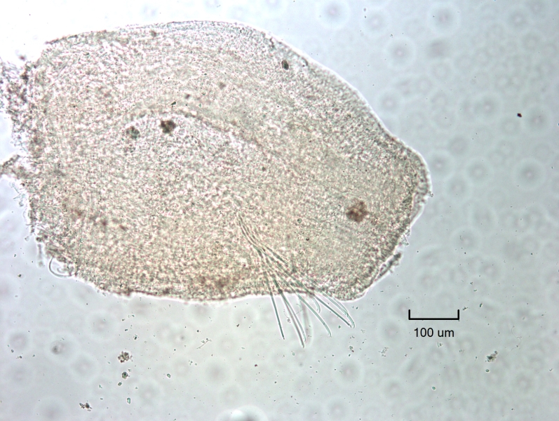 photomicrograph of a head fragment of a freshwater oligochaete worm. The mouth is very large, there are no dorsal chaetae, and there are only ventral chaetae in II by the mouth. The chaetae in II are very long and swept forward toward the mouth.