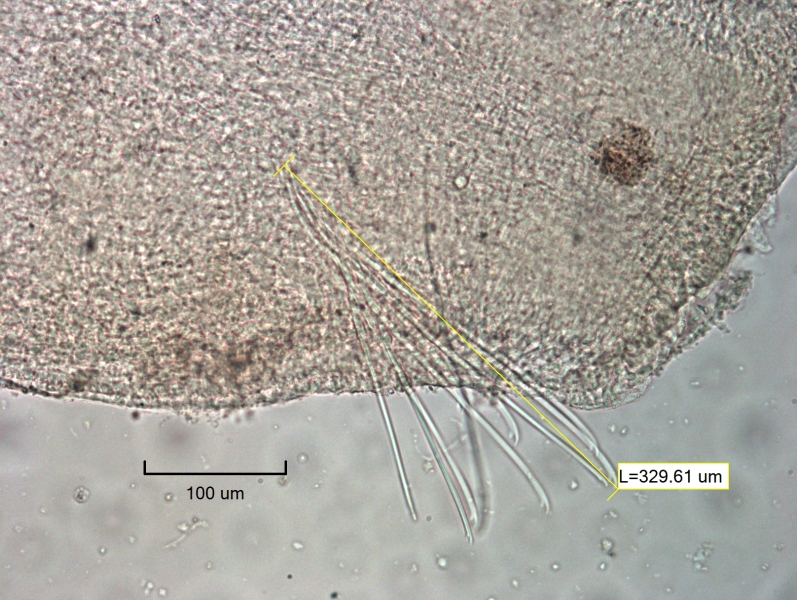 photomicrograph of part of a freshwater oligochaete worm. The only ventral chaetae are in II by the mouth. The chaetae in II are very long and swept forward toward the mouth, measured and labeled 329.61 um. The upper tooth of the bifid chaetae is longer than the lower.