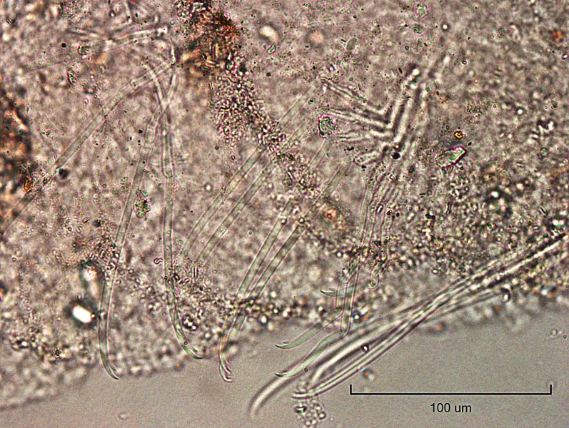 photomicrograph of part of a freshwater oligochaete worm showing several bundles of very long bifid chaetae, the upper tooth is much longer than the lower.
