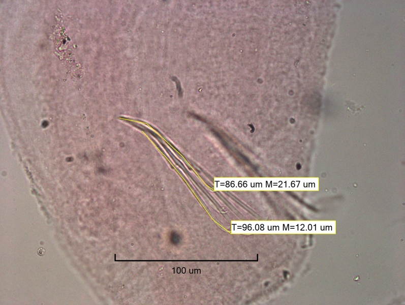photomicrograph of the head of a freshwater oligochaete worm. The ventral chaetae in II sweep forward toward the mouth, two are measured 86.66 um and 86.08 um.