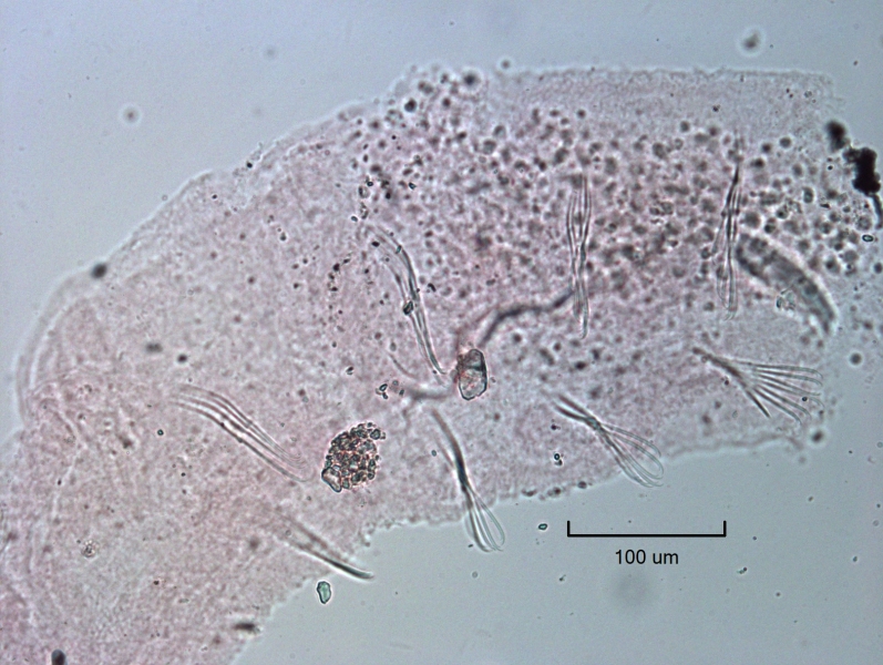 photomicrograph of back part of a freshwater oligochaete worm with bundles of bifid chaetae only on the ventral side, not the dorsal side