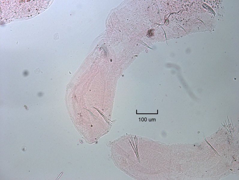 Photomicrograph of a freshwater oligochaete worm near some other worms. There are no dorsal chaetae and the head and mouth are strange, with the mouth large and terminal, with a little bit of a prostomium. There are chaetae swept forward toward the mouth and then a large gap in chaetae before the rest of the ventral chaetae restart.