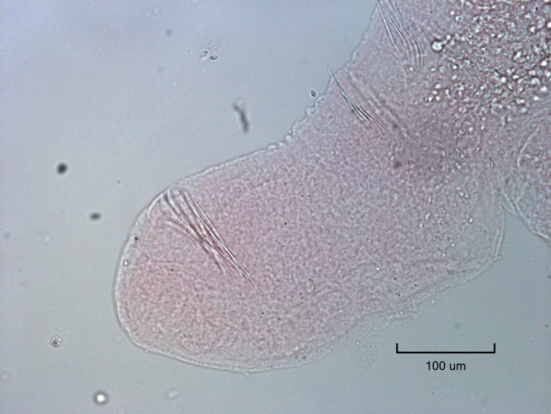photomicrograph of the head of a freshwater oligochaete worm with a strange head shape. The mouth is subterminal and at an angle just below what might be a prostomium. The ventral chaetae in II sweep forward and there is a gap with no chaetae before VI