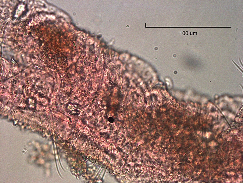 Photomicrograph of a worm. There are no somatic hairs (chaetae) on the dorsal side of the worm, just on the ventral side. These chaetae are long and simple-pointed.
