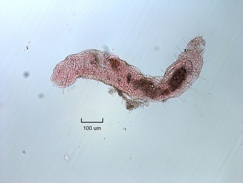 Photomicrograph of a worm with an enlarged mouth with a few longer somatic hairs (chaetae) by the mouth. The rest of the chaetae are sigmoid and single-pointed, only on the ventral side.