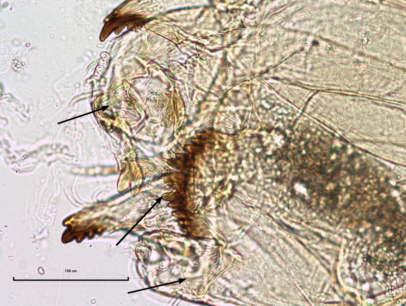 photomicrograph of the head of a chironomid midge larva with arrows pointing to the pecten epipharyngis (out of focus), the ventromental plate with a wavy edge which is 2/3 the width of the mentum, and the first lateral tooth of the mentum, the second tooth is fused to the first and appears like a notch. The texture of the head capsule is granular.
