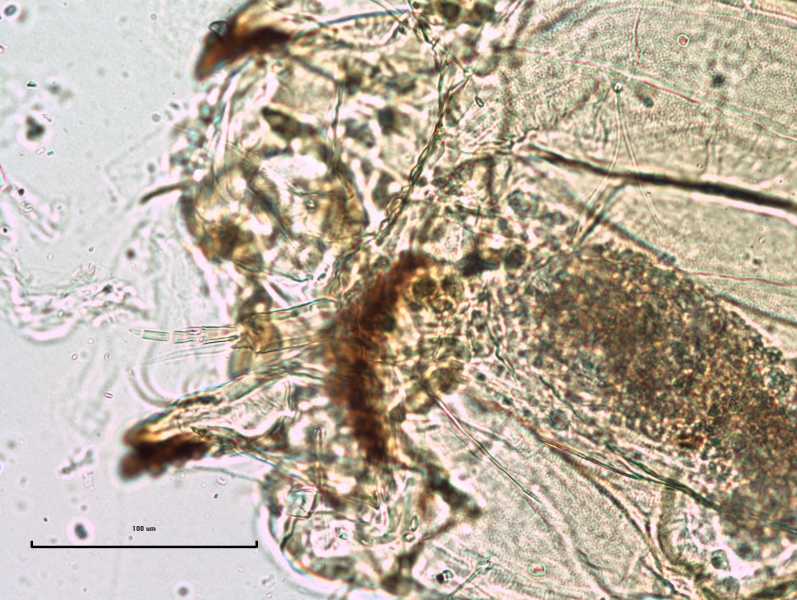 photomicrograph of the antenna of a chironomid midge larva, with about 5 segments and a blade about as long as the last four segments. The texture of the head capsule is granular.