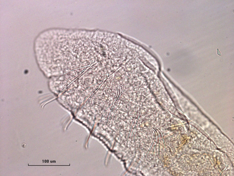 Photomicrograph of the anterior end of a worm with ventral chaetae, no dorsal chaetae in the first few segments, no eyes. Scale bar 100 um.