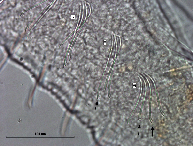 Photomicrograph of anterior chaetae in segments IV, V, and VI. An arrow points to one bifid chaetae in V which has the upper tooth about twice as long as the lower. Two arrows point to different shaped chaetae in VI: one has the upper teeth about equal, and the other has the upper tooth longer than the lower. Scale bar 100 um.