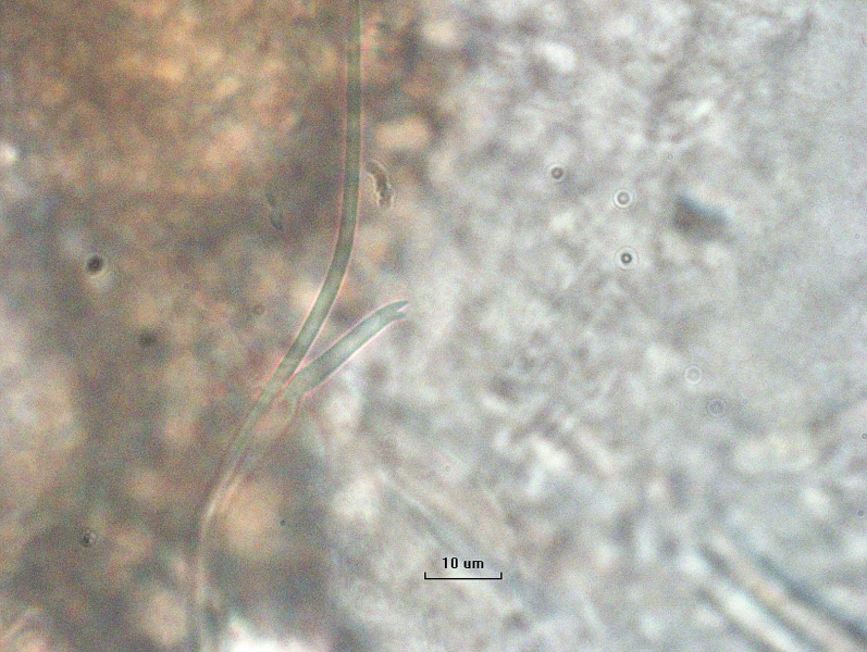 Photomicrograph of a bundle of chaetae of an oligochaete worm. There is one long hair chaetae and one bifid needle chaetae. The upper tooth is slightly curved and longer than the lower tooth. The needle chaetae is slightly bent distally from the nodulus in the middle. Scale bar 10 um.