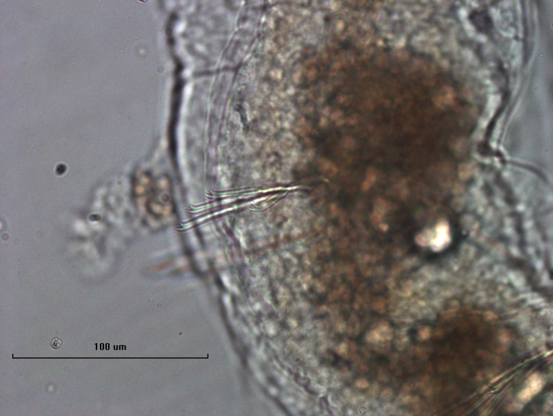 Photomicrograph of a bundle of bifid chaetae on an oligochaete worm. The chaetae have teeth that are about the same length. Scale bar 100 um.