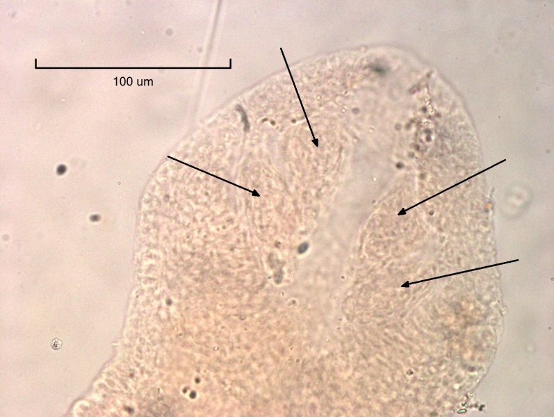Photomicrograph of the posterior end of a mounted oligochaete worm with arrows pointing to four gills in fossa, scale bar 100 um.
