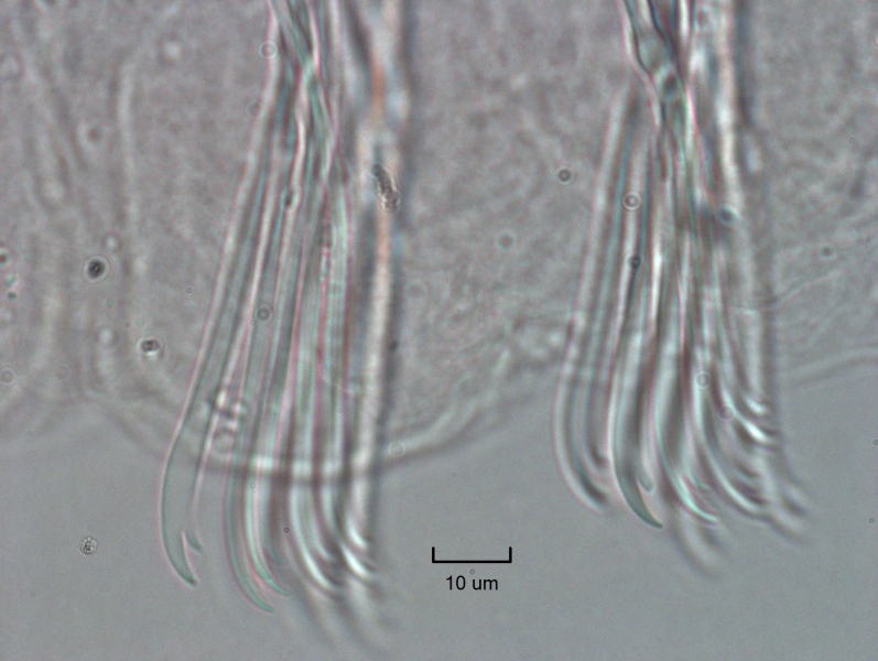 Photomicrograph of two bundles of somatic hairs (chaetae). There are about 5 chaetae per bundle with the upper tooth twice as long as the lower tooth