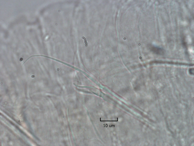 Photomicrograph of bundles of somatic hairs (chaetae). The dorsal bundles have one hair and two overlapping chaetae with toothed fan-shaped ends