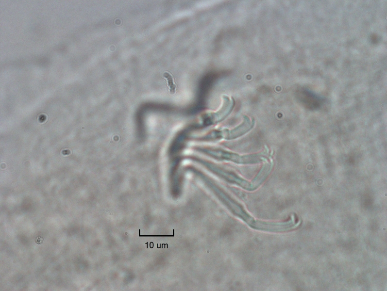 Photomicrograph of a bundle of somatic hairs (chaetae). There are about 5 bifid chaetae with the upper tooth much shorter than the lower tooth.