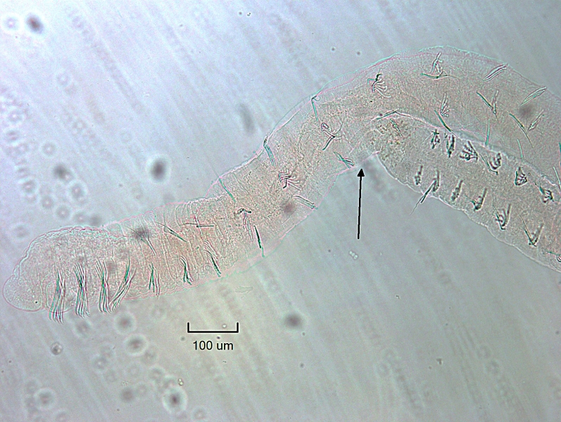 Photomicrograph of most of a worm with large somatic hair (chaetae) bundles on the ventral front few bundles and no bundles on the dorsal front few segments, shorter ventral chaetae after that, hairs and chaetae with fan-shaped ends on the ventral surface, and arrows pointing to finger-like appendages on the end of the worm