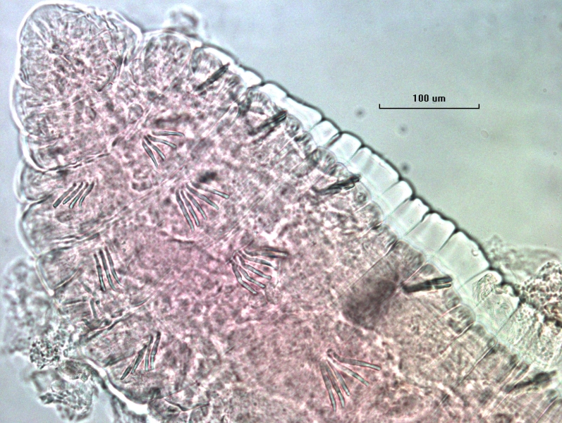 Photomicrograph of the head of a freshwater oligochaete worm with evenly spaced bundles of chaetae. All chaetae are simple and straight.