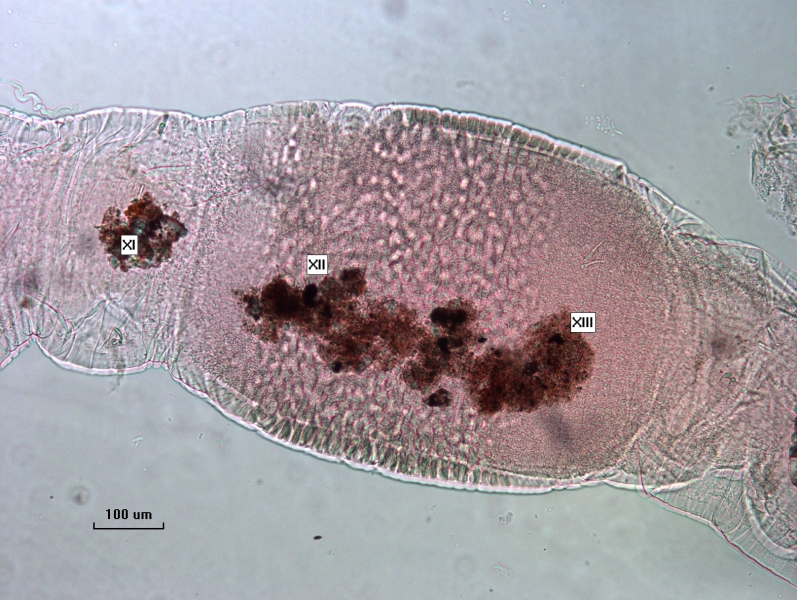 Photomicrograph of the clitellum of a freshwater oligochaete worm with segments XI, XII, and XIII. The thickening of the clitellum begins at XII.