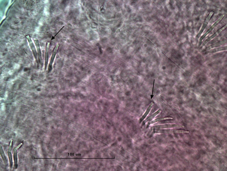 Photomicrograph of part of a freshwater oligochaete worm with evenly spaced bundles of chaetae. All chaetae are simple and straight, but many are broken. Two broken chaetae have arrows pointing to them.