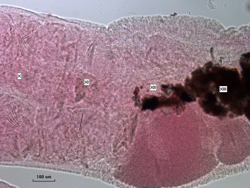 Photomicrograph of the clitellum of a freshwater oligochaete worm with segments X, XI, XII, and XIII. The thickening of the clitellum begins at XII. The chaetae are thin and slightly curved.