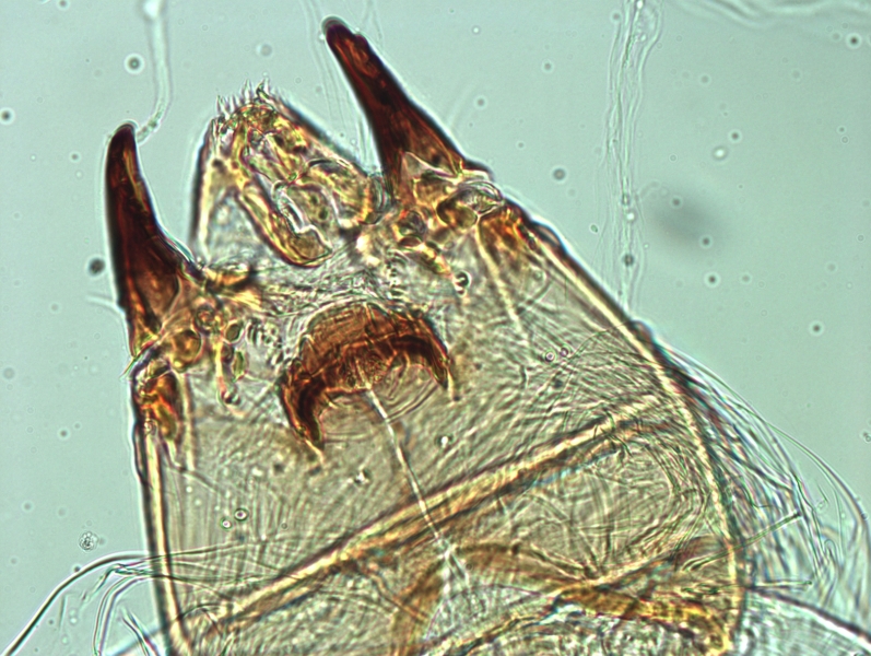 photomicrograph of the head capsule of a chironomid midge larvae showing mandibles, maxilla, mentum, and labrum.