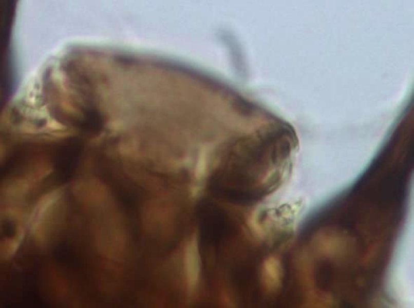 photomicrograph of the dorsal view of the head capsule of a chironomid midge larvae showing very short antennae between the labrum and mandibles