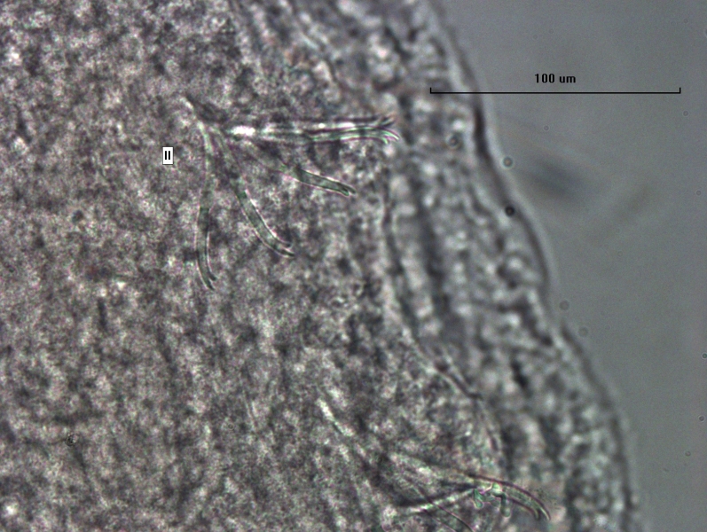 Photomicrograph of worm chaetae showing sets with a longer upper tooth and a shorter lower tooth. The segment is labeled II.