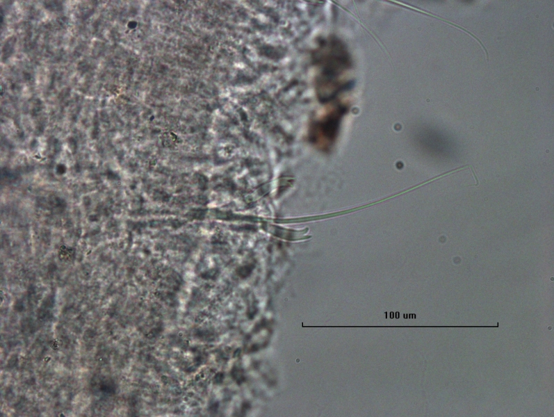 Photomicrograph of worm chaetae showing a combination of long thin hairs and chaetae with two large teeth.