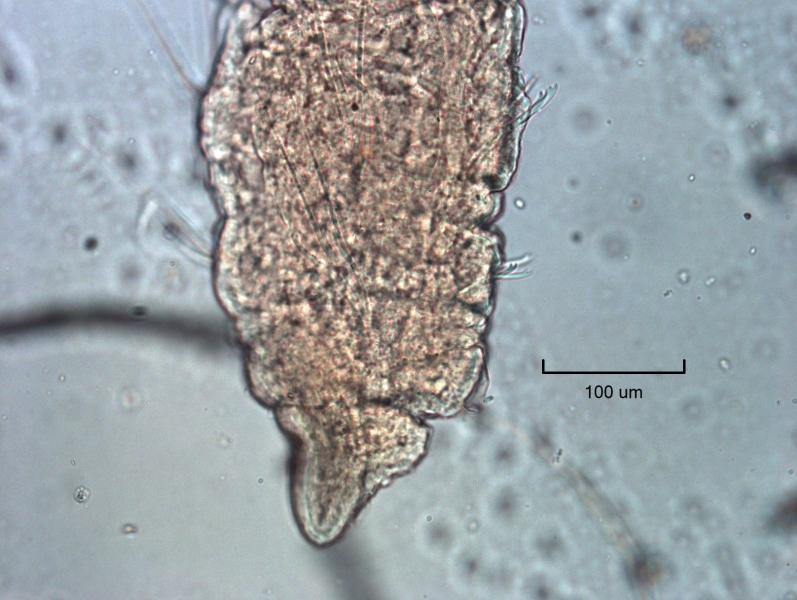 photomicrograph of the head of a freshwater oligochaete worm with dorsal hairs and ventral bifid chaetae.