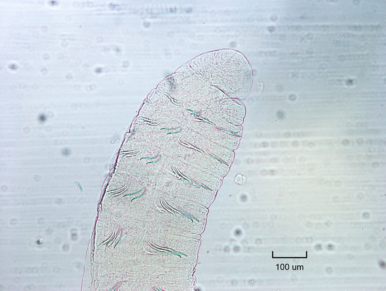 photomicrograph showing the front end of a worm with sets of two chaetae in each bundle