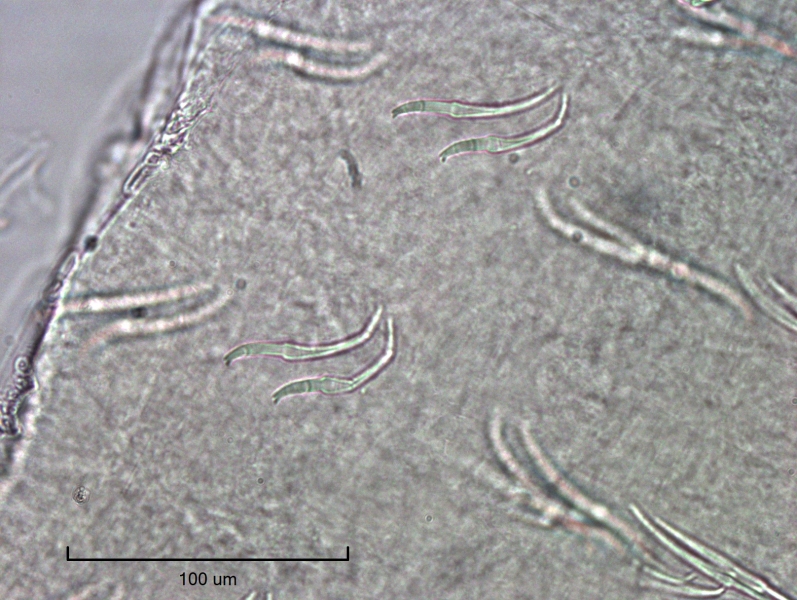 photomicrograph of sets of two worm hairs (chaetae) with the upper tooth much smaller than the lower tooth