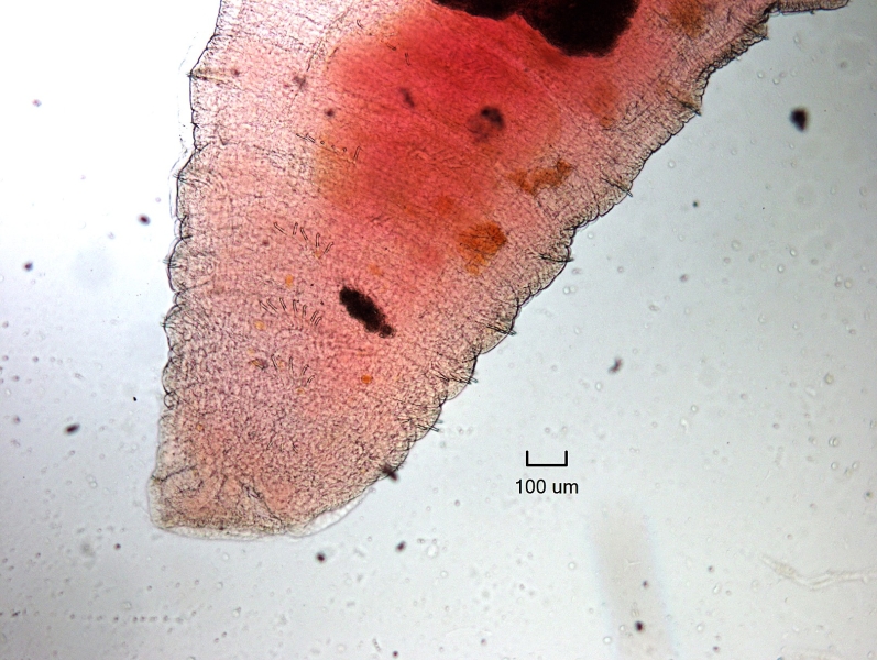 Photomicrograph of the head of an oligochaete worm with short bifid chaetae.