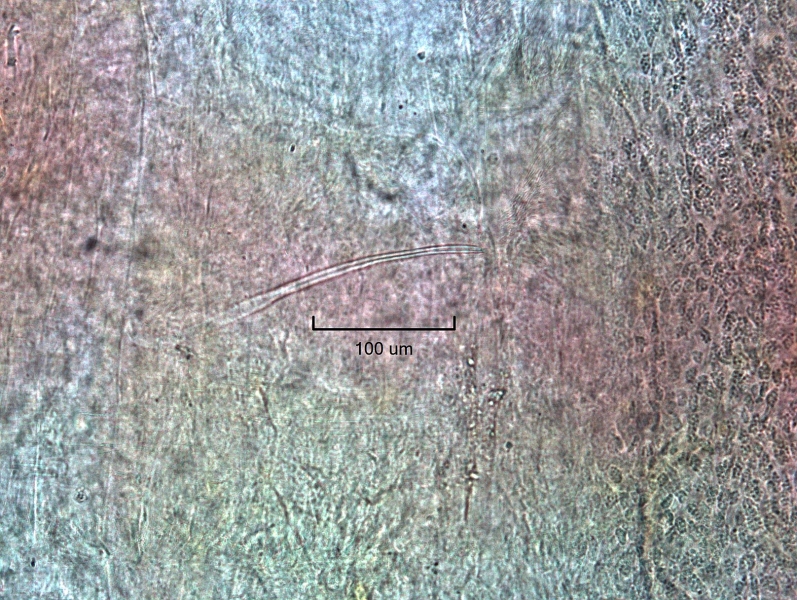 photomicrograph of the reproductive structure of an oligochaete worm. The specialized chaetae is long and thin like a needle.