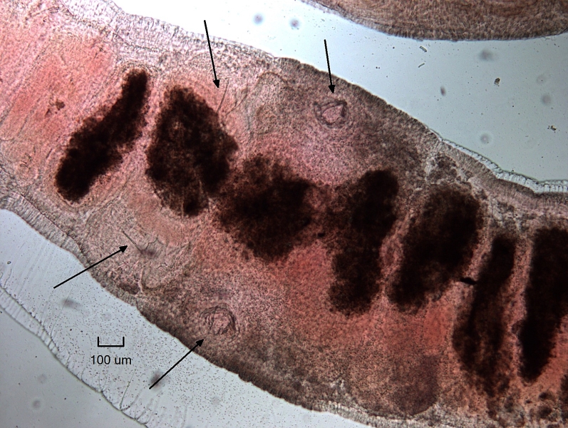 Photomicrograph of the reproductive area of an oligochaete worm with arrows pointing to structures. The skin is thickened with two ring-like structures. Before that area there are two thin reproductive chaetae.