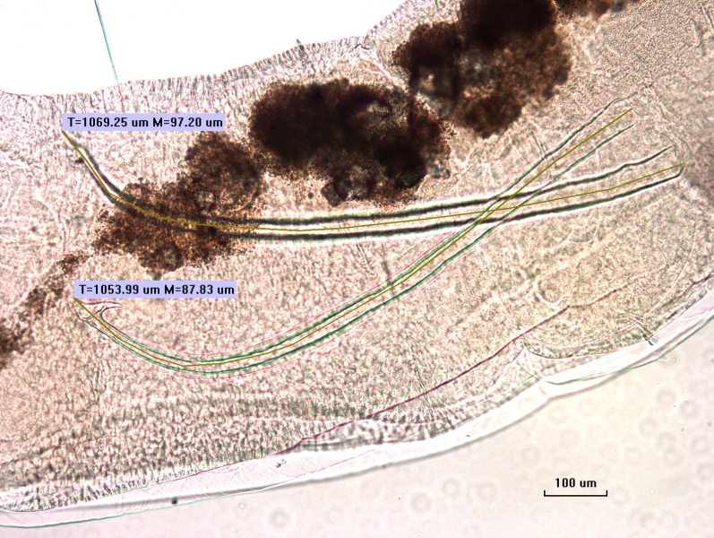 Photomicrograph of the reproductive area of an oligochaete worm showing two penis sheaths measuring 1069.25 μm and 1053.99 μm. The head plate has two pointed lobes.