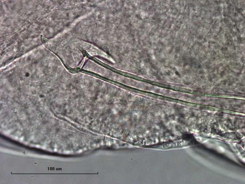 Photomicrograph of the reproductive structure of an oligochaete worm. The head plate of the penis sheath has a triangular pointed upper lobe and a triangular lower lobe draping to one side. The shaft has two walls, though it is hard to see.