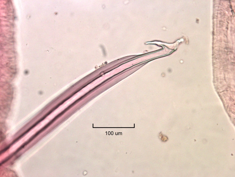 Photomicrograph of the reproductive structure of an oligochaete worm. The penis sheath here is protruding from the body wall, making it very distinct. The shaft has an inner wall and a thick outer wall. The head plate has two pointed lobes.