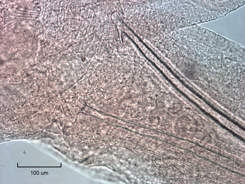 Photomicrograph of the reproductive structures of an oligochaete worm. There are two penis sheaths, one with the head plate viewed facially and one viewed laterally. The head plate of the first penis sheath has a rounded triangular upper lobe and a small lobe draping to one side. The shaft is double-walled. The second head plate definitely has a lower lobe, but the shape of the upper lobe isn't very pointed.