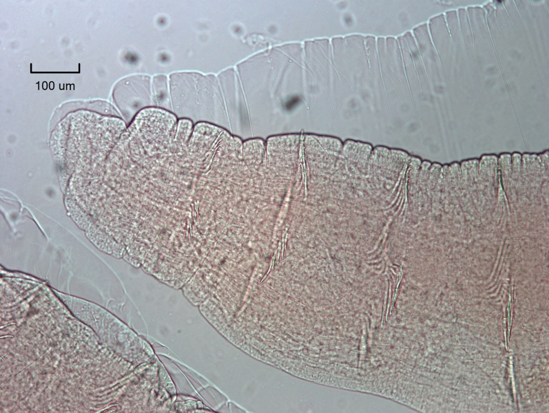 photomicrograph of the head of a freshwater oligochaete worm with bundles of bifid chaetae. This worm is fairly thick quickly, so it may have regrown its head.