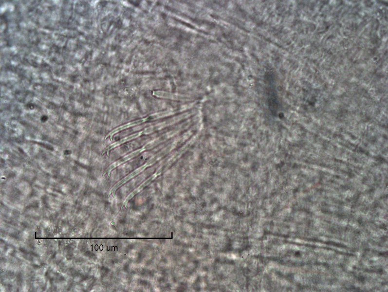 Photomicrograph of part of a freshwater oligochaete worm showing a bundle of 6 chaetae, with the upper tooth shorter and thinner than the lower tooth.