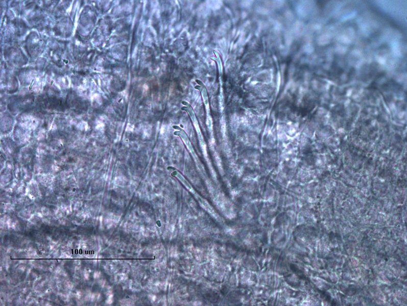 Photomicrograph of a bundle of somatic hairs (chaetae) of an oligochaete worm. The chaetae have an upper tooth that is slightly longer and just as thick as the lower tooth.