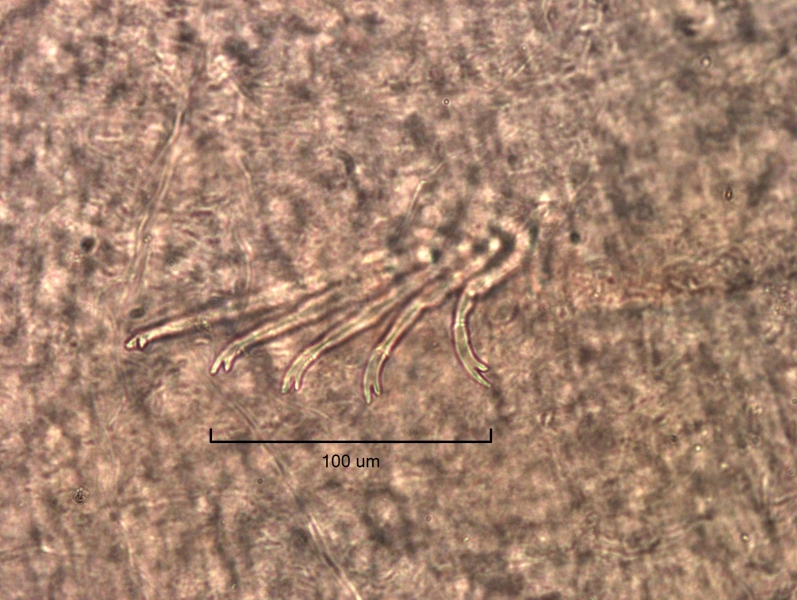 Photomicrograph of a bundle of somatic hairs (chaetae) of an oligochaete worm. The chaetae have a long upper tooth and shorter lower tooth.