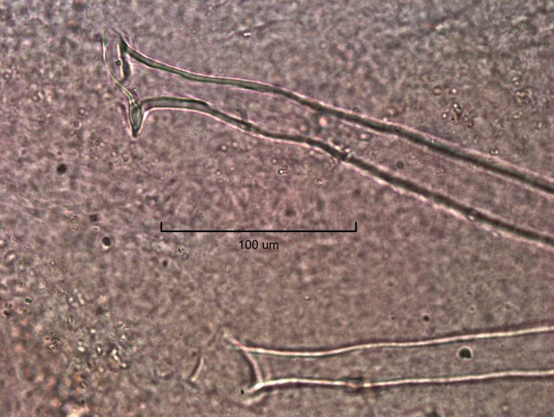 photomicrograph of the reproductive structures of a freshwater oligochaete worm. There are two penis sheaths, one in focus and the other out of focus. The in focus one is viewed from the side and the shape of the penis sheath is unknown. The out of view one has a small triangular head plates with the top pointed.