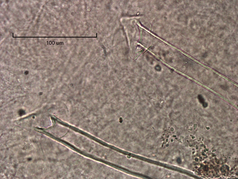 photomicrograph of the reproductive structures of a freshwater oligochaete worm. There are two penis sheaths with small triangular head plates. The top is pointed and the bottom is rounded and overhangs the opening a little