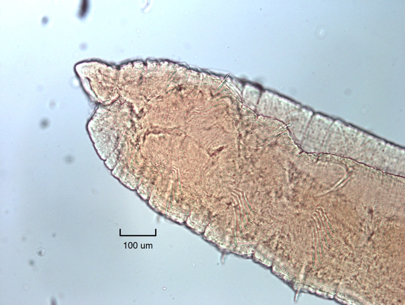 photomicrograph of the head of a freshwater oligochaete worm with bundles of bifid chaetae with the upper tooth longer than the lower tooth. 