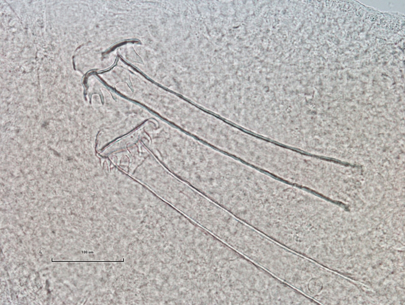 Photomicrograph of the reproductive structures of an oligochaete worm. There are two long conical penis sheaths. The head plates drape in front and have scalloped margins.