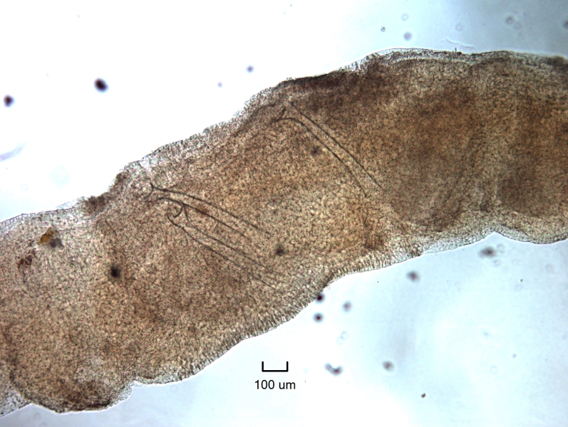 Photomicrograph of part of a freshwater oligochaete worm showing the clitellum. There is a set of penis sheaths and then a third penis sheath farther back.