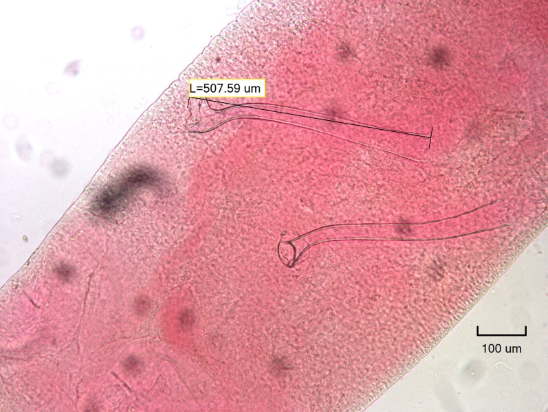 Photomicrograph of the reproductive structures of an oligochaete worm. There are two long conical penis sheaths. The head plates are different, one is pushed forward in a cone and the other is draped to the side. One measures L=507.59 μm.