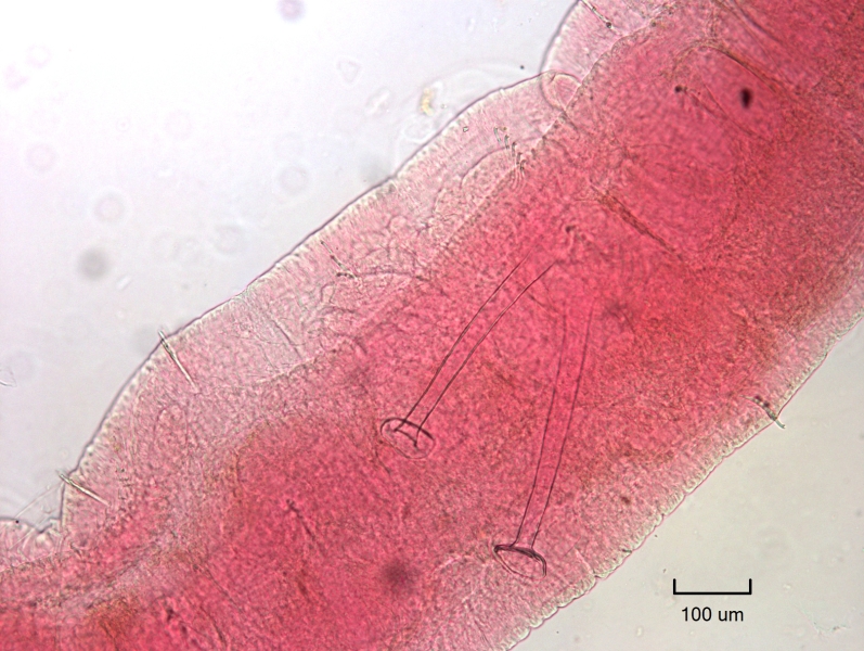 Photomicrograph of the reproductive structures of an oligochaete worm. There are two long conical penis sheaths. The head plates are circular and at right angles to the shaft.